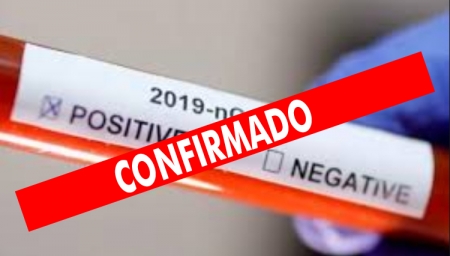 Moradora do Ceará que visita São Lourenço do Sul testa positivo para Coronavírus