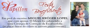 MIGUEL KRÜGER LOPES