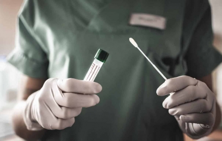 Estado programa distribuição de 35 mil testes rápidos para Covid-19