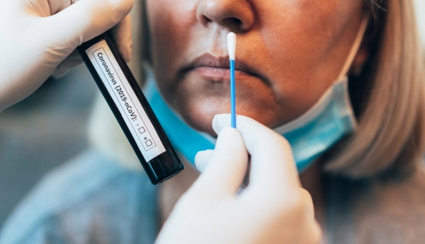 75 casos positivos foram registrados nos últimos 7 dias em São Lourenço do Sul