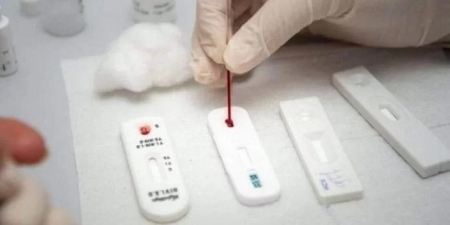 TESTES RÁPIDOS: São Lourenço deverá receber um total de 1260 testes rápidos - COVID-19